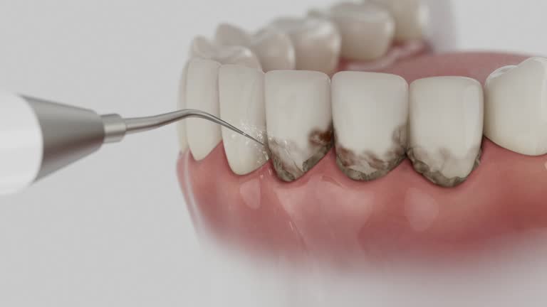 Reliable Wisdom Tooth Removal contractor in Carroll County County, NH by Dentist Open Now
